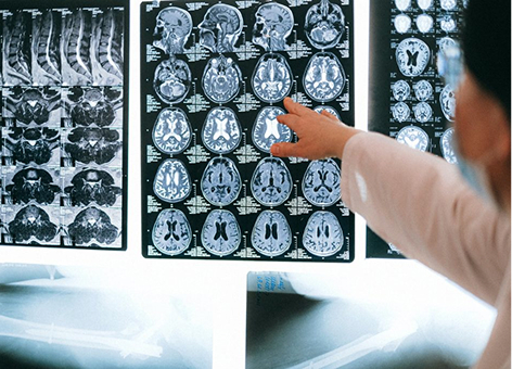 Imagerie Médicale